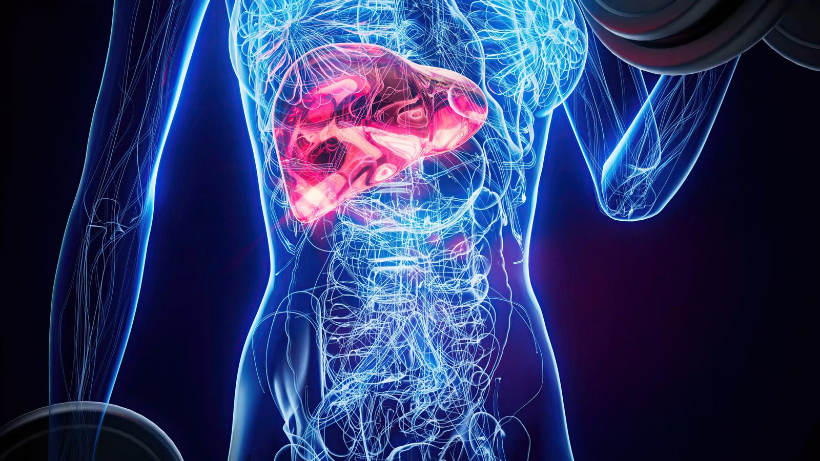 Dietician for Fatty Liver in Delhi